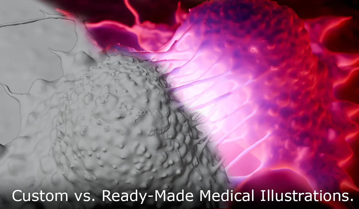 Custom Medical Illustration vs Ready-Made Assets: A Research-First Decision Guide